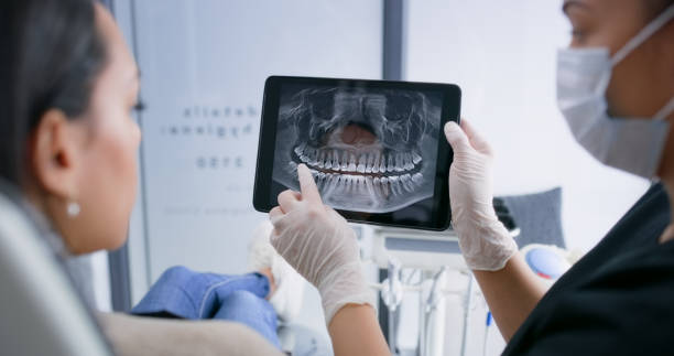 Licensed Tooth Extraction service in San Fernando, CA - Smile Center Dentistry